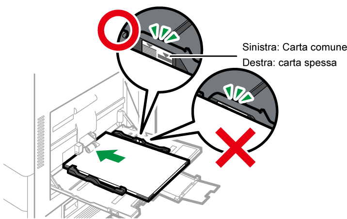 Illustrazione vassoio bypass